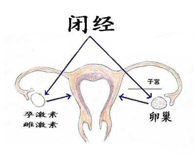 闭经两个月该怎么办，探索原因与解决方案