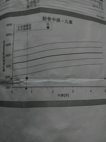 三个月宝宝骨密度低的关注与理解