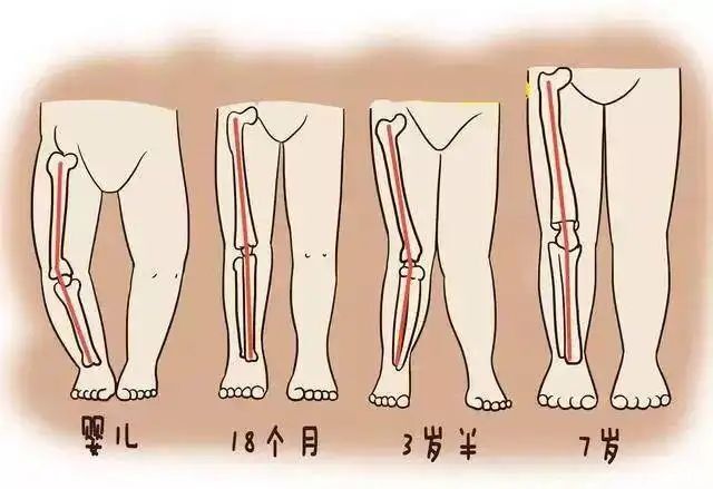 三个月宝宝腿伸不直的常见原因与处理方法