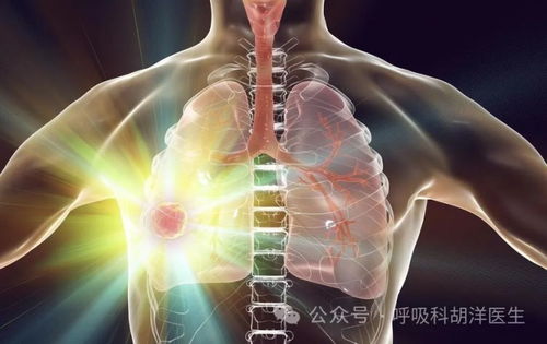 一个月两次CT，医学检查的重要性与个人健康管理